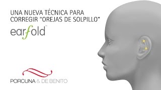 Nueva técnica para corregir las orejas de soplillo Earfold [upl. by Eiramllij]