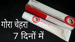 गोरा चेहरा सिर्फ 7 दिनों में Melalite 15 Cream Review Hindi [upl. by Ylrebmit]