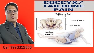 Tail Bone painCoccyx bone pain Cure in Neurotherapy Haldwani [upl. by Ahsiekel]