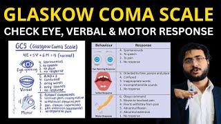 Mastering the Glasgow Coma Scale Complete Guide Scoring System and Clinical Applications [upl. by Naitsirhk]