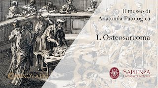 Il Museo di Anatomia Patologica  L Osteosarcoma [upl. by Elwin]