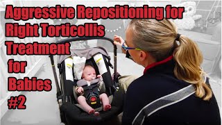 2R Aggressive Repositioning Right Torticollis Treatment Torticollis Treatment in Babies [upl. by Thetis688]