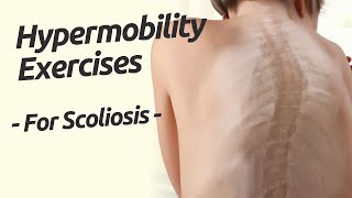 Hypermobility exercises for scoliosis [upl. by Jurkoic318]