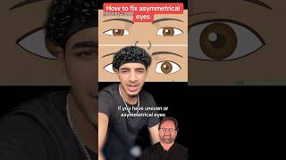 How to FIX Asymmetrical Eyes  Surgeon Reacts [upl. by Aset742]