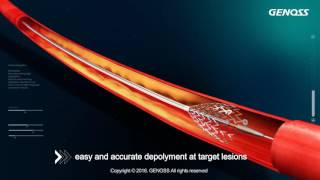 Genoss Peripheral Stent System [upl. by Eneloc835]