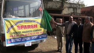 Anti Leprosy Day celebrated in Kathua [upl. by Mcfadden]