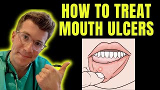 How to recognise and treat Mouth Ulcers getting rid of canker sores  Doctor ODonovan explains [upl. by Enecnarf512]