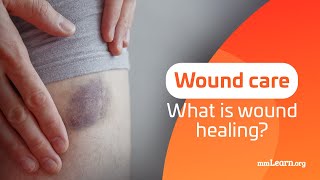 The Science of Wound Healing  Part 2 What is Wound Healing [upl. by Sashenka]