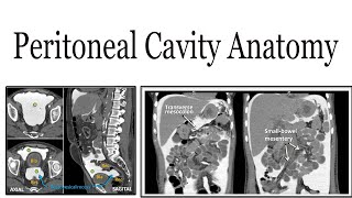 Peritoneal cavity anatomy [upl. by Ordway753]