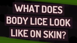 What does body lice look like on skin [upl. by Jilly]