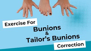 Exercise for Bunion and Tailors Bunion Bunionette Correction [upl. by Schober]