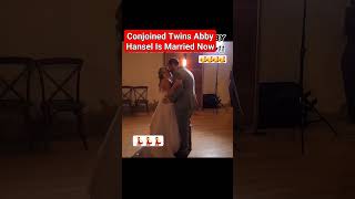 Abby Hensel One of the Conjoined Twins Gets Married viral abby trending [upl. by Enneira]