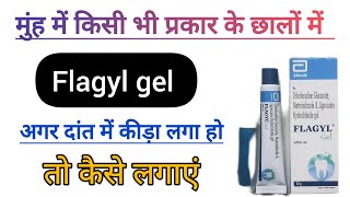 Flagyl gel  मुंह के छालों की दमदार दवाई। दांत में कीड़ा अगर दर्द दे तो इसका उपयोग करे। कैसे लगाएं [upl. by Enixam459]