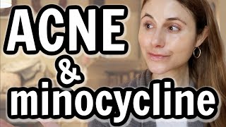 Minocycline versus doxycycline for acne Dr Dray [upl. by Ydoj]