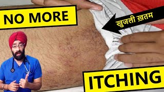 How to cure itching in private part  fungal infection  daad khaj khujli ka ilaj  DrEducation [upl. by Hulbard383]