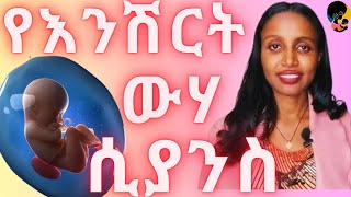 የእንሽርት ውሃ ማነስማወቅ ያለባችሁ በሙሉ Understanding Oligohydramnios Causes Risks and Management [upl. by Conard]