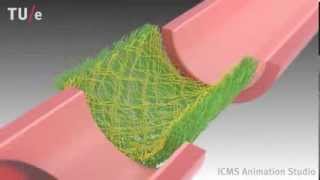 Instructive Supramolecular Scaffolds for In Situ Cardiovascular Tissue Engineering [upl. by Letisha989]