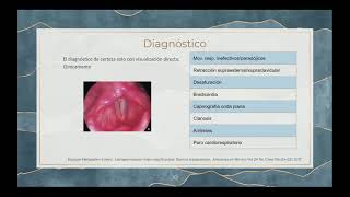 Laringoespasmo en el paciente pediatrico [upl. by Hauser521]