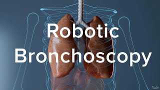 Lung Biopsy Via Robotic Bronchoscopy  Yale Medicine Explains [upl. by Aisitel83]