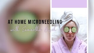 At Home MICRONEEDLING [upl. by Ahtram]