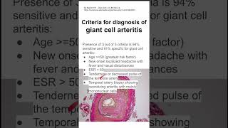 Criteria for diagnosis of giant cell arteritis [upl. by Leuqim]