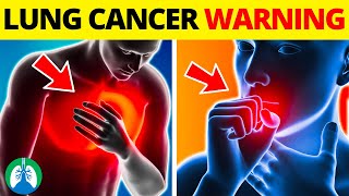 Top 10 Early Warning Signs of Lung Cancer  NEVER IGNORE THIS [upl. by Clark96]