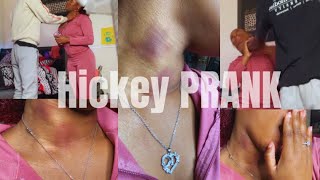 Hickey Prank On My Protective boyfriend got heated [upl. by Basir715]