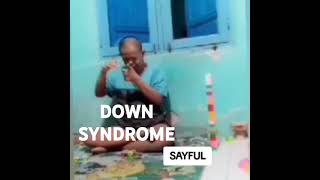 DOWN SYNDROME [upl. by Ahseyt]