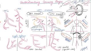 Basics of angiographic views during left heart catheterization [upl. by Mcquoid]