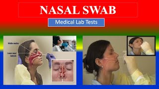 NASAL SWAB   Medical Lab Tests  What is   Uses  Need  Preparation  Results [upl. by Assiren138]