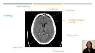 CT Head Sectional Anatomy  ARRT Registry and CQR Review [upl. by Ibloc363]