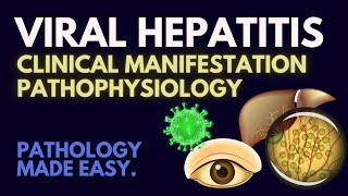 Viral Hepatitis I Pathophysiology Made Easy [upl. by Brigette]