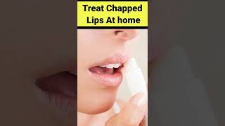 How to treat chapped lips at home [upl. by Pussej]