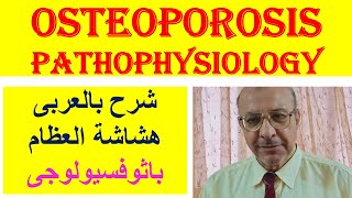 Osteoporosis Pathophysiology شرح بالعربى هشاشة العظام باثوفسيولوجى [upl. by Gery]