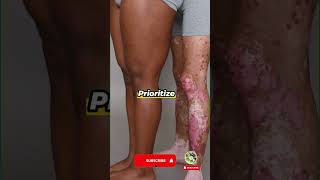 Early Signs of Psoriasis Dont Ignore the Scalp shorts health [upl. by Sig]