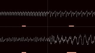 Oscilloscope repellantmold  a432 [upl. by Ahel]