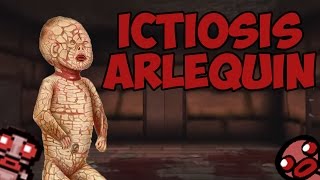 Ictiosis Arlequín  Harlequin Baby  The Binding of Isaac Rebirth [upl. by Oiril984]