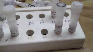 ODD methodOuchterlony Double diffusion practical method [upl. by Leona733]