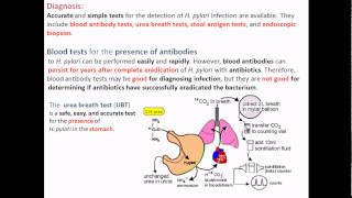 Helicobacter pylori diagnosis [upl. by Barbabra]