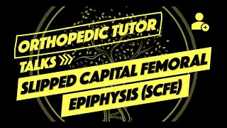 Slipped Capital Femoral Epiphysis SCFE [upl. by Llehcram]