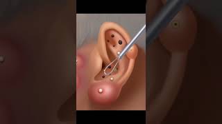 ASMR Ear Cleaning and Treatment for Sleep and Relaxation asmr ear animation treatment [upl. by Arrec]