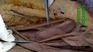 DISSECTION OF FRONT OF THIGH PART1 BY DR MITESH DAVE [upl. by Anaili575]