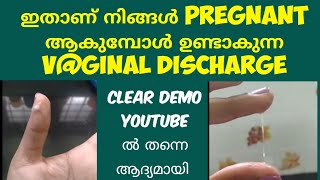 2 Types Of Pregnancy Discharge Deechus world Malayalam [upl. by Aisetra]