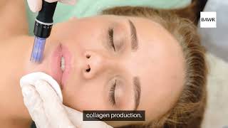 How to Choose the Best Microneedling Provider in dallastx [upl. by Gelasias]