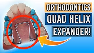 Quad Helix Expanders  EVERYTHING YOU NEED TO KNOW [upl. by Notsud]