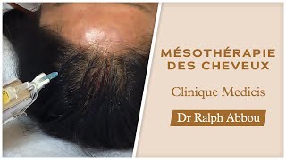 Mésothérapie des cheveux à Paris  Clinique Médicis [upl. by Aisercal]