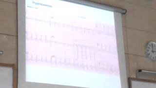 Dr Hany Gamal Hypokalemia 2  Hyperkalemia [upl. by Nedak860]