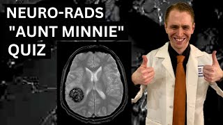 Neuroradiology quotAunt Minniequot Quiz [upl. by Amalie213]