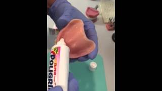 Applying denture adhesive paste [upl. by Arlinda879]