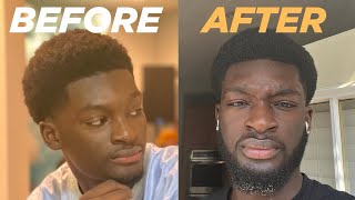 How to Grow a Full Beard in 6 Months  My Proven Beard Growth Journey [upl. by Genia794]